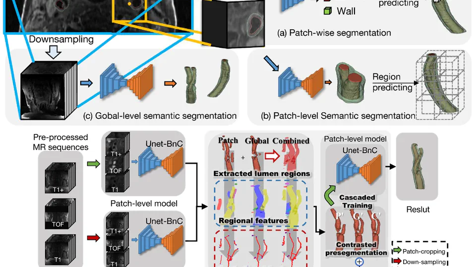 Cascaded residual U-net for fully automatic segmentation of 3D carotid artery in high-resolution multi-contrast MR images