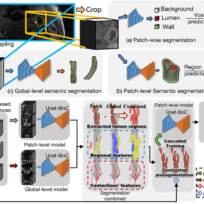 Cascaded residual U-net for fully automatic segmentation of 3D carotid artery in high-resolution multi-contrast MR images